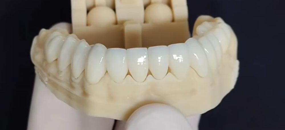 Lentes de dissilicato de lítio sobre modelo, vista frontal dos dentes anteriores inferiores